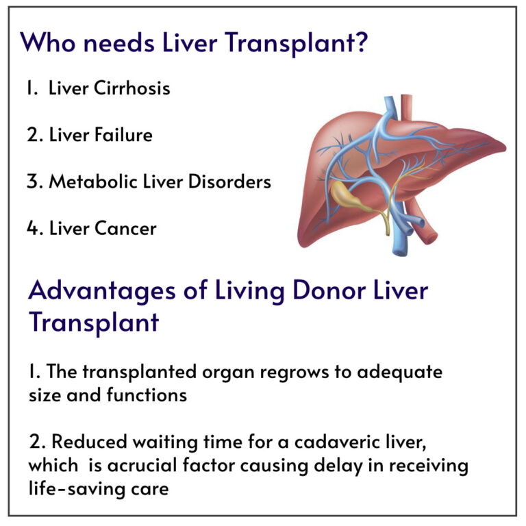 Liver Transplant